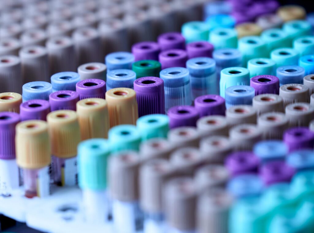 racks of research chemicals in vials
