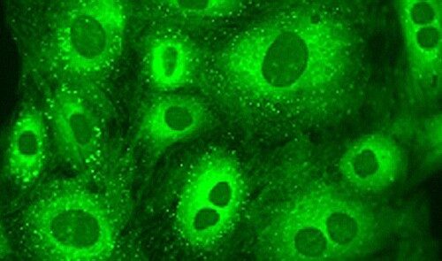 Cells stained with Technetium complexed with fluorescent BODIPY phosphine.